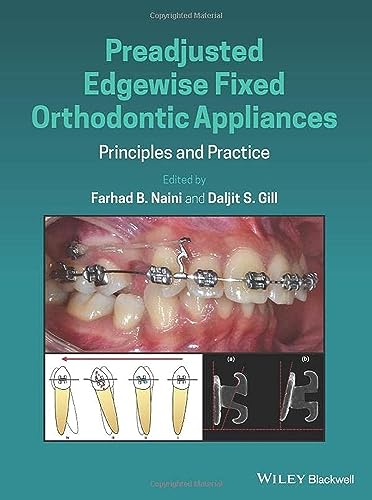 Preadjusted Edgewise Fixed Orthodontic Appliances: Principles and Practice von Blackwell Pub