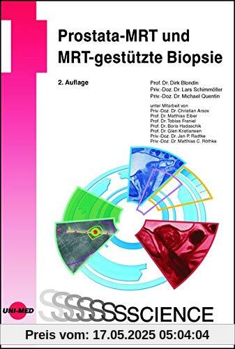 Prostata-MRT und MRT-gestützte Biopsie (UNI-MED Science)