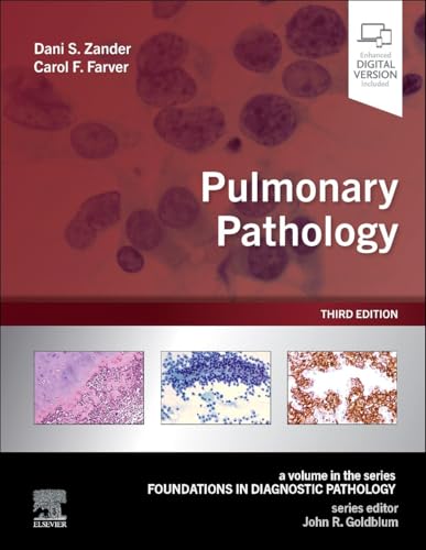 Pulmonary Pathology (Foundations in Diagnostic Pathology)