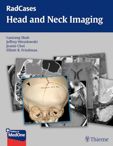 RadCases Head and Neck Imaging (Radcases Plus Q&A) von Thieme
