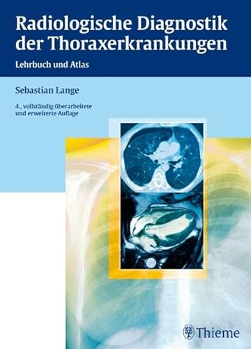Radiologische Diagnostik der Thoraxerkrankungen von Georg Thieme Verlag