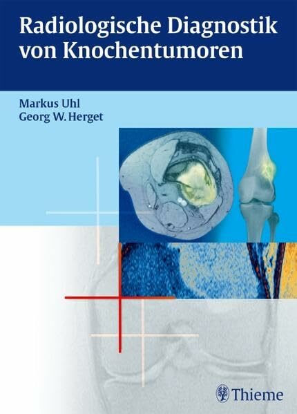 Radiologische Diagnostik von Knochentumoren Radiologische Diagnostik von Knochentumoren
