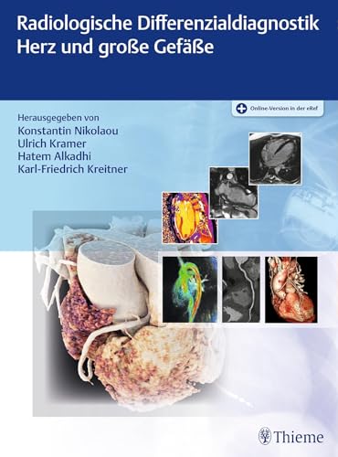 Radiologische Differenzialdiagnostik Herz und große Gefäße von Georg Thieme Verlag