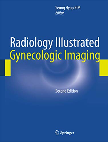 Radiology Illustrated: Gynecologic Imaging von Springer