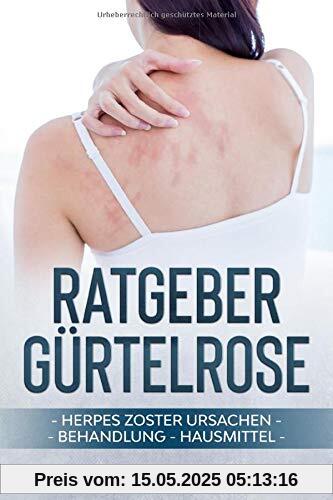 Ratgeber Gürtelrose: Herpes Zoster Ursachen Behandlung Hausmittel Ratgeber Gürtelrose: Herpes Zoster Ursachen Behandlung Hausmittel