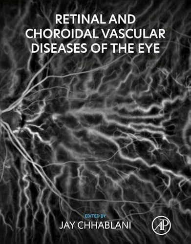 Retinal and Choroidal Vascular Diseases of the Eye Retinal and Choroidal Vascular Diseases of the Eye von Academic Press