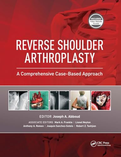 Reverse Shoulder Arthroplasty: A Comprehensive Case-Based Approach von Slack