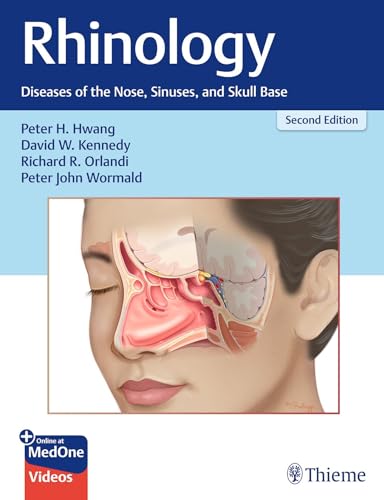 Rhinology: Diseases of the Nose, Sinuses, and Skull Base von Thieme Medical Publishers