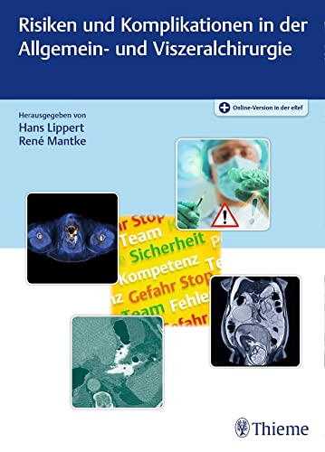 Risiken und Komplikationen in der Allgemein- und Viszeralchirurgie von Georg Thieme Verlag