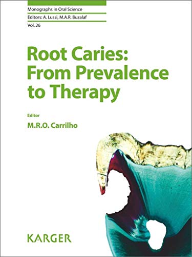 Root Caries: From Prevalence to Therapy (Monographs in Oral Science, Band 26) von S. Karger