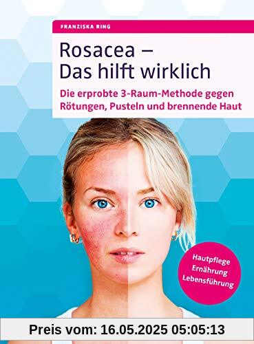 Rosacea - Das hilft wirklich: Die erprobte 3-Raum-Methode gegen Rötungen, Pusteln und brennende Haut, Hautpflege, Ernährung, Lebensführung Rosacea - Das hilft wirklich: Die erprobte 3-Raum-Methode gegen Rötungen, Pusteln und brennende Haut, Hautpflege, Ernährung, Lebensführung
