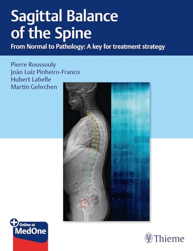 Sagittal Balance of the Spine: From Normal to Pathology: A Key for Treatment Strategy von Thieme Medical Publishers