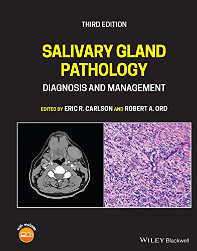 Salivary Gland Pathology: Diagnosis and Management von Wiley-Blackwell