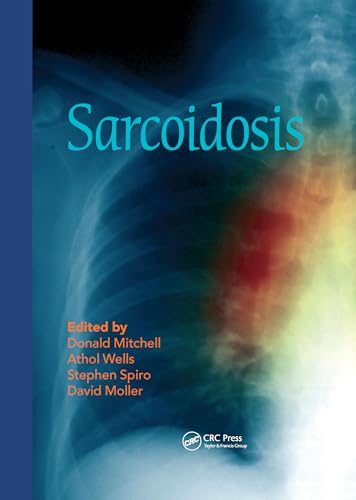 Sarcoidosis von CRC Press