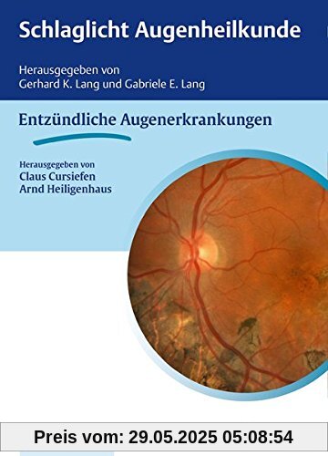 Schlaglicht Augenheilkunde: Entzündliche Erkrankungen (Reihe, Schlaglicht Augenheilkunde)