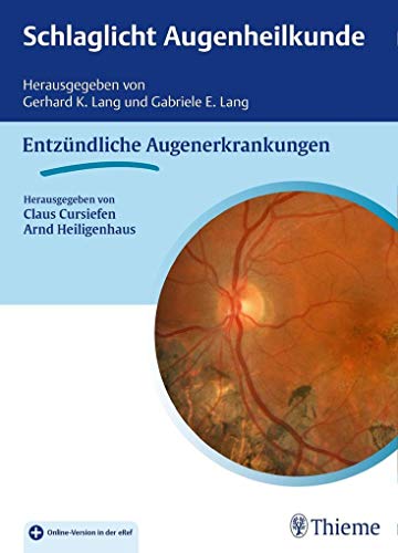 Schlaglicht Augenheilkunde: Entzündliche Erkrankungen von Georg Thieme Verlag