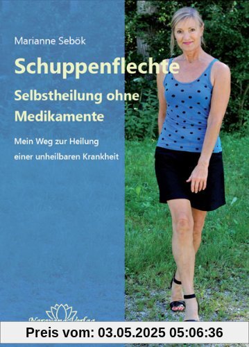 Schuppenflechte - Selbstheilung ohne Medikamente: Mein Weg zur Heilung einer unheilbaren Krankheit