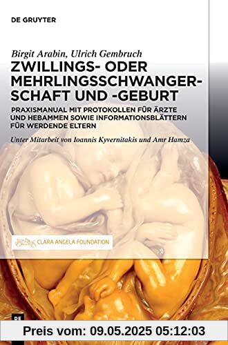 Schwangerschaft, Geburt und Wochenbett von Zwillingen und höhergradigen Mehrlingen: Praxismanual für Ärzte und Hebammen sowie werdende Eltern Schwangerschaft, Geburt und Wochenbett von Zwillingen und höhergradigen Mehrlingen: Praxismanual für Ärzte und Hebammen sowie werdende Eltern