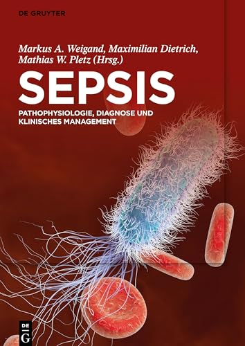 Sepsis: Pathophysiologie, Diagnose und klinisches Management