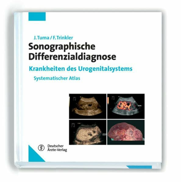 Sonographische Differenzialdiagnose. Krankheiten des Urogenitalsystems: Systematischer Atlas Sonographische Differenzialdiagnose. Krankheiten des Urogenitalsystems: Systematischer Atlas