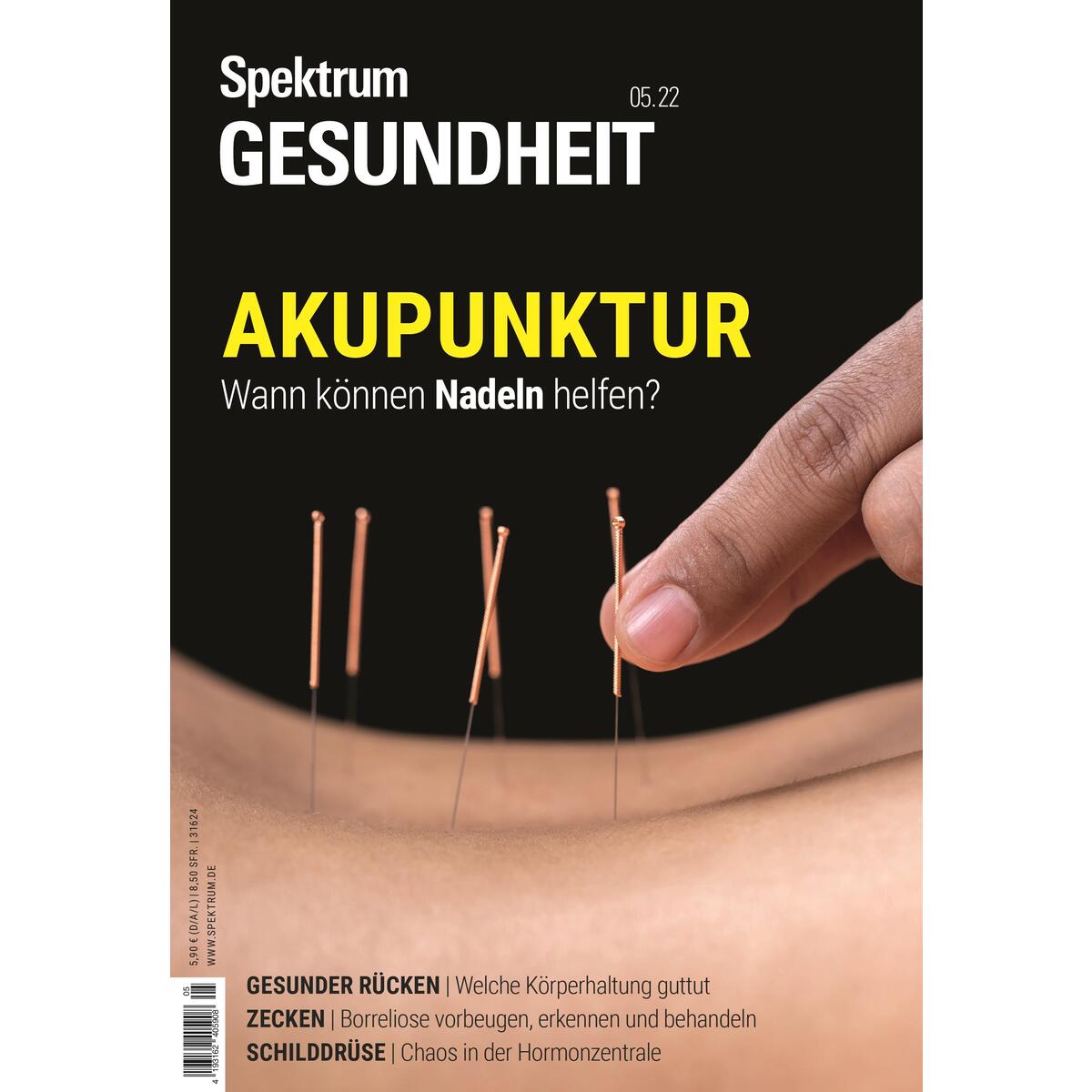 Spektrum Gesundheit- Akupunktur von Spektrum D. Wissenschaft
