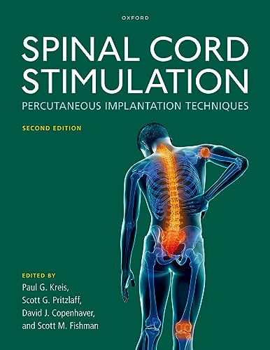 Spinal Cord Stimulation: Percutaneous Implantation Techniques Spinal Cord Stimulation: Percutaneous Implantation Techniques von Oxford University Press Inc