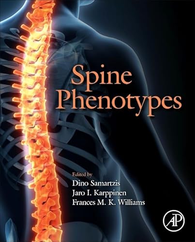 Spine Phenotypes von Academic Press