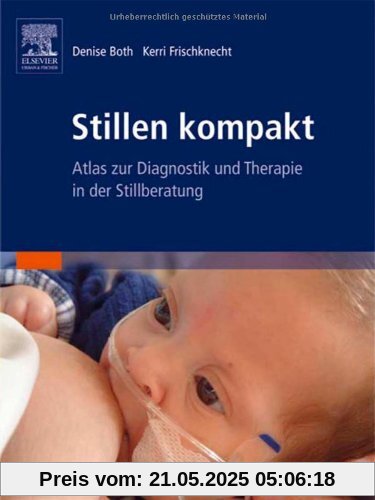 Stillen kompakt: Atlas zur Diagnostik und Therapie in der Stillberatung