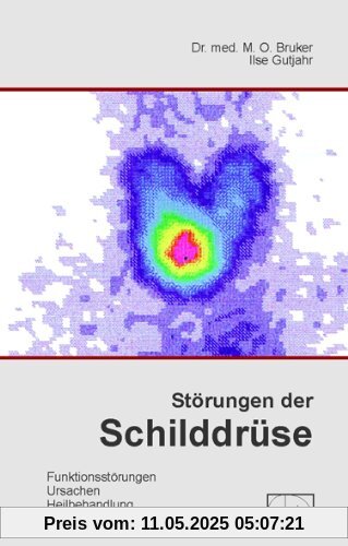 Störungen der Schilddrüse: Was man über die Schilddrüse wissen sollte. Störungen, Ursachen, Heilbehandlung, Warnung vor jodiertem Salz