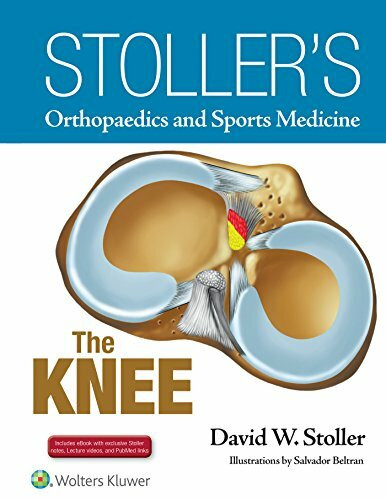 Stoller's Orthopaedics and Sports Medicine: The Knee: Includes Stoller Lecture Videos and Stol...