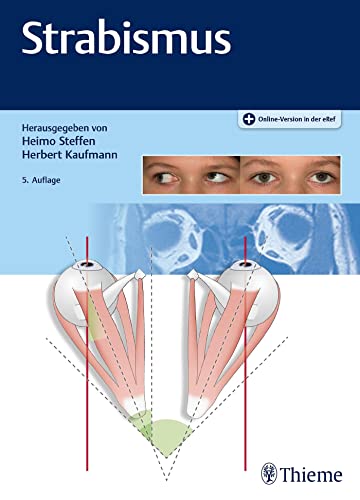 Strabismus: Plus Online-Version in der eRef