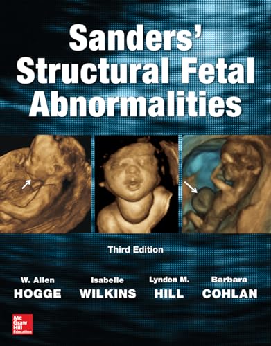 Structural Fetal Abnormalities Structural Fetal Abnormalities