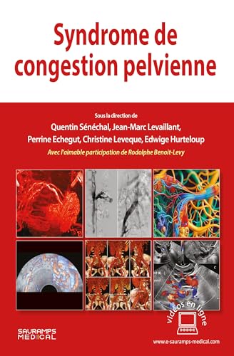 Syndrome de congestion pelvienne von SAURAMPS MEDICA