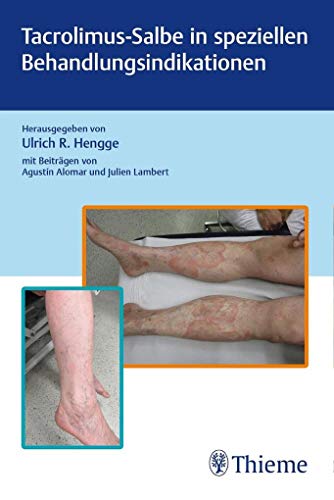 Tacrolimus-Salbe in speziellen Behandlungsindikationen Tacrolimus-Salbe in speziellen Behandlungsindikationen von Thieme
