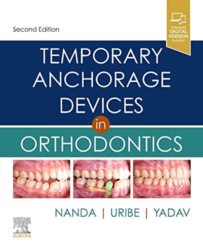 Temporary Anchorage Devices in Orthodontics von Elsevier