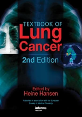 Textbook of Lung Cancer