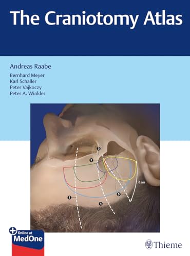 The Craniotomy Atlas: Plus Online at MedOne