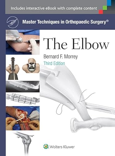 The Elbow (Master Techniques in Orthopaedic Surgery)