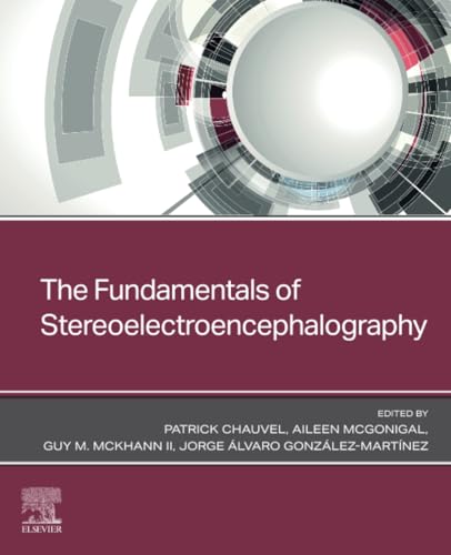 The Fundamentals of Stereoelectroencephalography von Elsevier