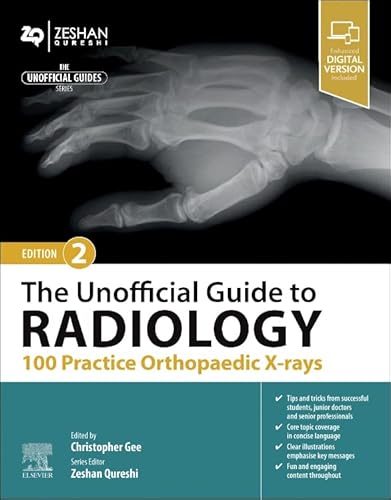 The Unofficial Guide to Radiology: 100 Practice Orthopaedic X-rays (Unofficial Guides) von Elsevier