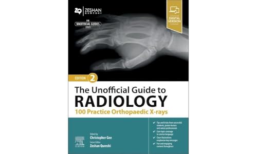 The Unofficial Guide to Radiology: 100 Practice Orthopaedic X-rays (Unofficial Guides) von Elsevier