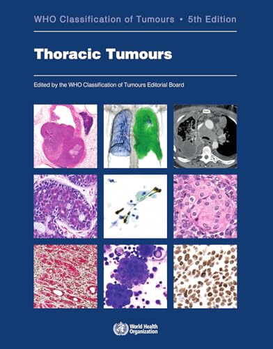 Thoracic Tumours: Who Classification of Tumours (World Health Organization Classification of Tumours, Band 5) von IARC
