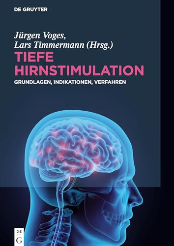 Tiefe Hirnstimulation: Grundlagen, Indikationen, Verfahren