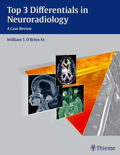 Top 3 Differentials in Neuroradiology von Thieme, Stuttgart