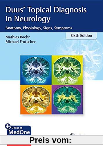 Topical Diagnosis in Neurology: Anatomy, Physiology, Signs, Symptoms