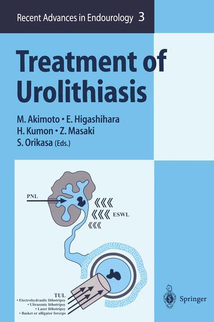 Treatment of Urolithiasis von Springer Japan