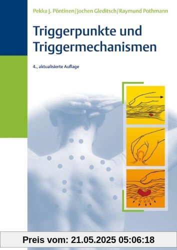 Triggerpunkte und Triggermechanismen Triggerpunkte und Triggermechanismen