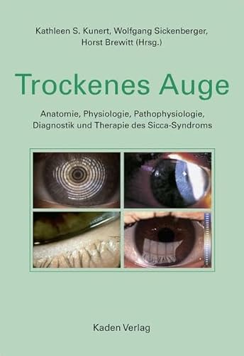 Trockenes Auge: Anatomie, Physiologie, Pathophysiologie, Diagnostik und Therapie des Sicca-Syndroms von Kaden Verlag