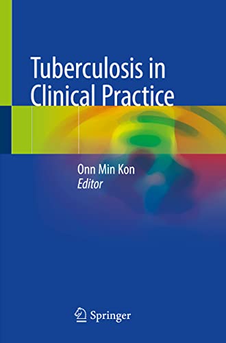 Tuberculosis in Clinical Practice von Springer