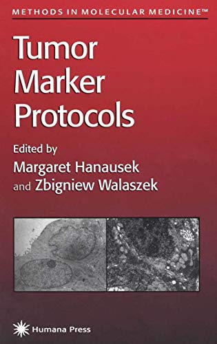 Tumor Marker Protocols (Methods in Molecular Medicine, 14, Band 14)